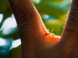 What Bit Me? Spot These 13 Bug Bites 